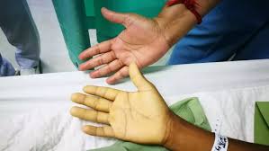 Anaemia Profile